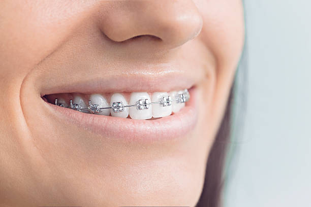 Dental Inlays and Onlays in St Joseph, MO